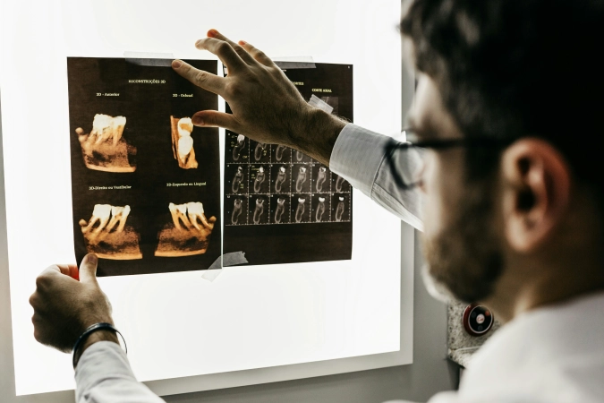Skeletal Dysplasia, Kidney, Cervical, and Hip Dysplasia