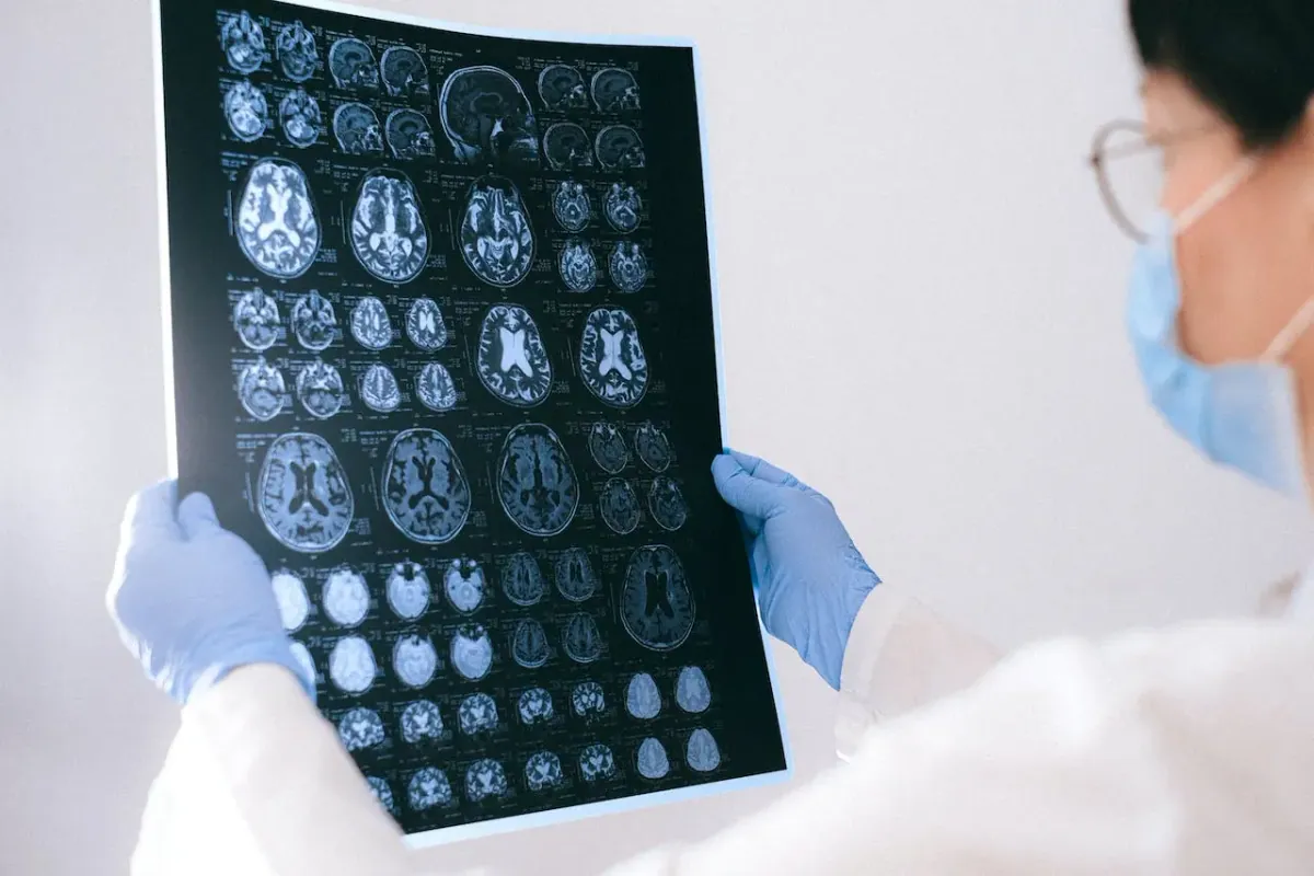 Intracranial Pressure: Ultimate Guide for Caregiving