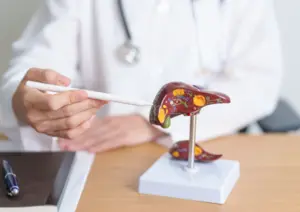Fatty Liver Disease
