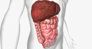 Nonalcoholic Fatty Liver Disease